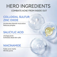 Salicylic Acid Acne Treatment Drying Lotion