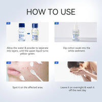 Salicylic Acid Acne Treatment Drying Lotion